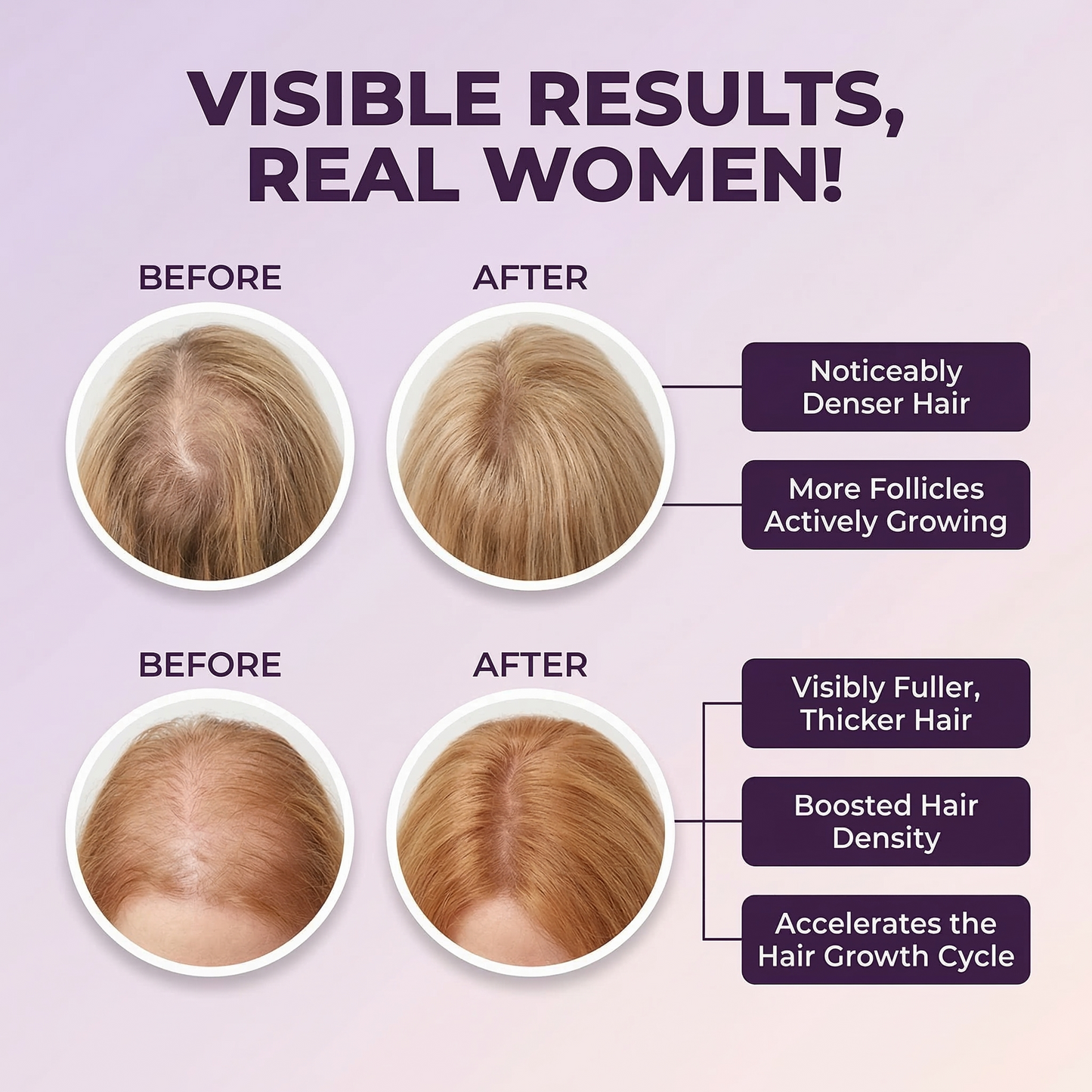 Folivara Hair Gummies